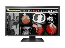 EIZO MX317W-BK Main Image from Front EIZO MX317W-BK Main Image from Front