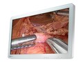 Eizo Nanao 26 CuratOR Full HD LED-LCD Surgical Monitor, White, EX2620, 35869144, Monitors - Medical