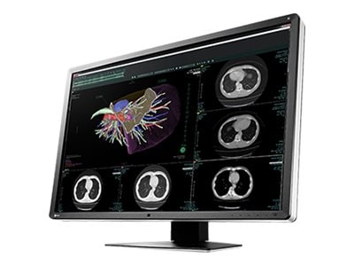 eizo radiforce rx660