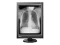 Eizo Nanao 21.3 RadiForce GX240 2MP LED-LCD Monitor, GX240-CL-P-BK, 16149854, Monitors - Medical