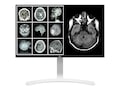 LG 27 HJ712C-W 4K Ultra HD LED-LCD IPS Clinical Review Monitor, 27HJ712C-W, 33684701, Monitors - Medical LG 27 HJ712C-W 4K Ultra HD LED-LCD IPS Clinical Review Monitor, 27HJ712C-W, 33684701, Monitors - Medical