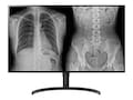 LG 31.5 8MP IPS Diagnostic Monitor, Black, 32HL512D-B, 37540828, Monitors - Medical