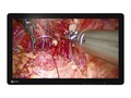 Eizo Nanao 26 CuratOR Full HD LED-LCD 3D Surgical Monitor, Black White, EX2620-3D, 35869161, Monitors - Medical