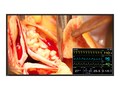 Eizo Nanao 48.5 LX491W-BK Full HD LED Medical Display, LX491W-BK, 35812391, Monitors - Medical