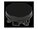 Parsec PRO4H4L01B                     Image 4 from Left-angle