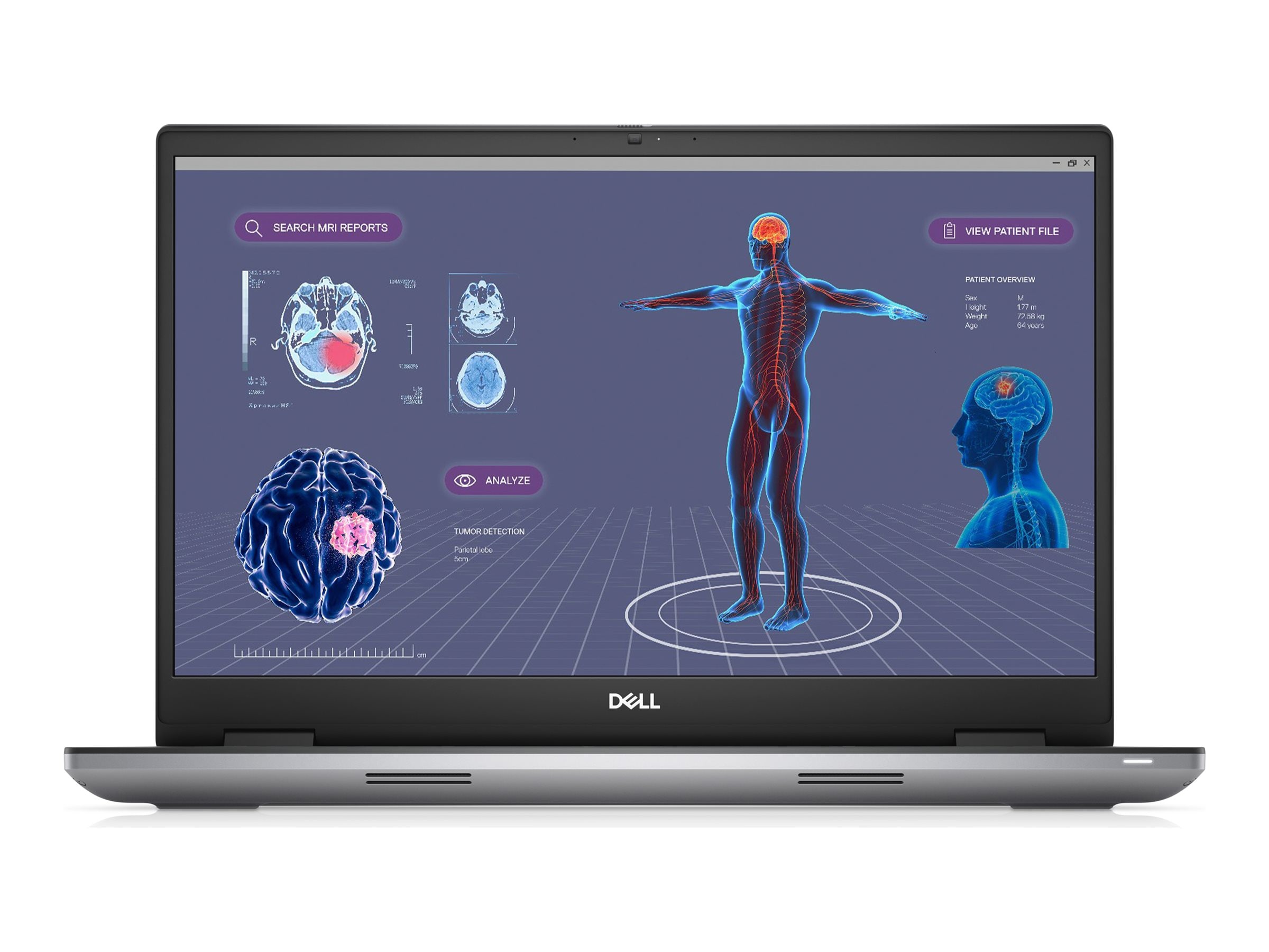 Dell Mobile Precision 7780 Core i9-13950HX 64GB 1TB PCIe ax BT (3GCR6)