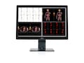 Barco Coronis C Fusion 6MP-1H No DC card: one MDCC-6530 Color Diagnostic Display, required accessories - U, T9702943B, 42192208, Monitors - Medical Barco Coronis C Fusion 6MP-1H No DC card: one MDCC-6530 Color Diagnostic Display, required accessories - U, T9702943B, 42192208, Monitors - Medical