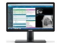Barco Eonis C 2MP-22: one MDRC-2422 Color Review Display, Standard, K9610941B , 41914786, Monitors - Medical Barco Eonis C 2MP-22: one MDRC-2422 Color Review Display, Standard, K9610941B , 41914786, Monitors - Medical