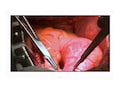 LG 27 FDA Class II 8MP Surgical Monitor, 27HJ713S-W, 41130327, Monitors - Medical LG 27 FDA Class II 8MP Surgical Monitor, 27HJ713S-W, 41130327, Monitors - Medical