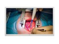 LG 55 MH5K-W 4K Ultra HD LED-LCD Surgical Display, 55MH5K-W, 41689441, Monitors - Medical