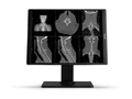 Barco NIO C 2MP-1H NO DC CARD: 1 MDNC-2521 COLOR DIAGNOSTIC 21.3Inch DISPLAY WITHOUT PROTECTIVE COVER, K9610761B, 42078381, Monitors - Medical Barco NIO C 2MP-1H NO DC CARD: 1 MDNC-2521 COLOR DIAGNOSTIC 21.3Inch DISPLAY WITHOUT PROTECTIVE COVER, K9610761B, 42078381, Monitors - Medical